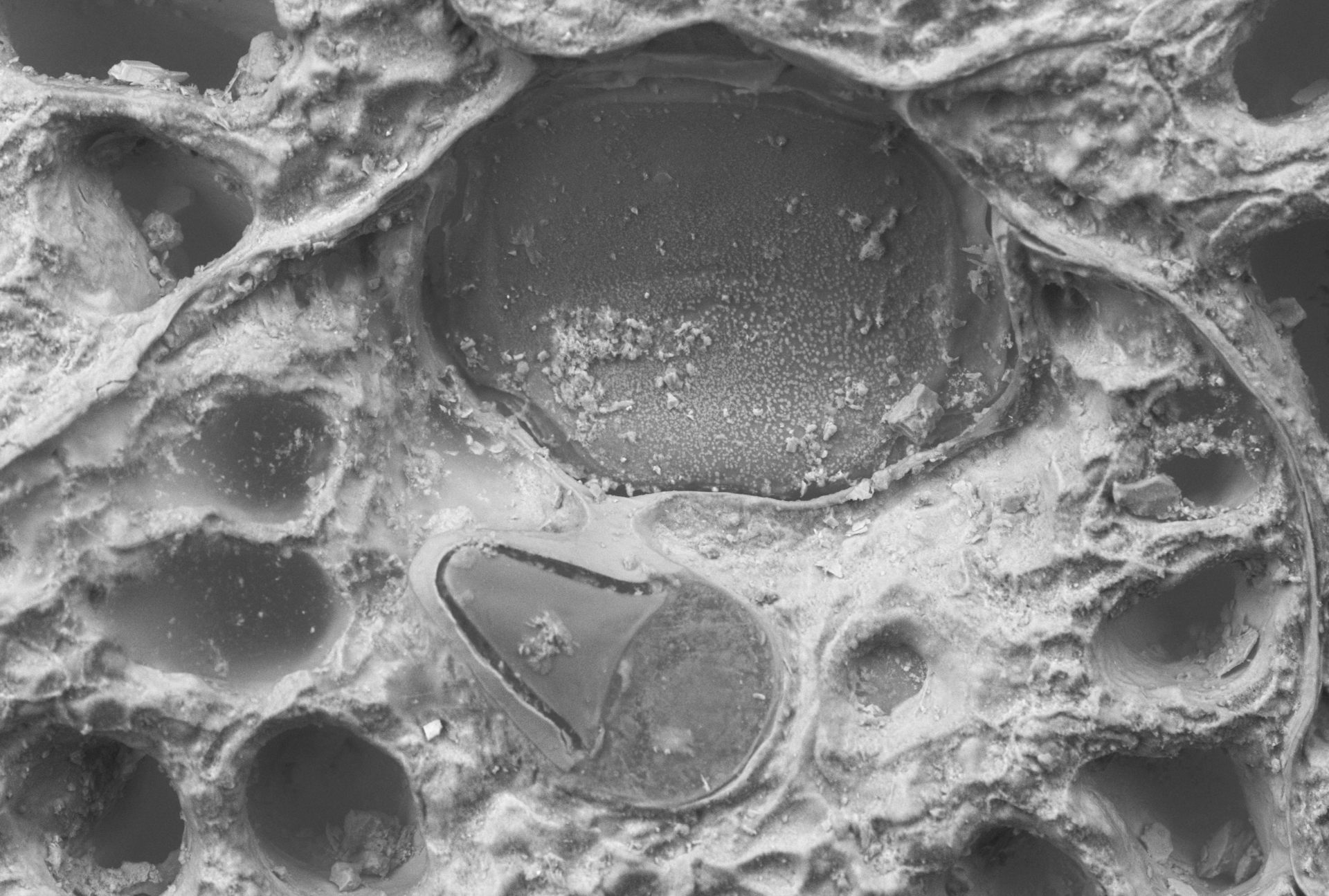 Bilde som viser avicularium hos Hippoporina harmsworthi