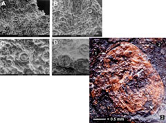 Mikroskopbilder av Idas mageinnhold og planteceller